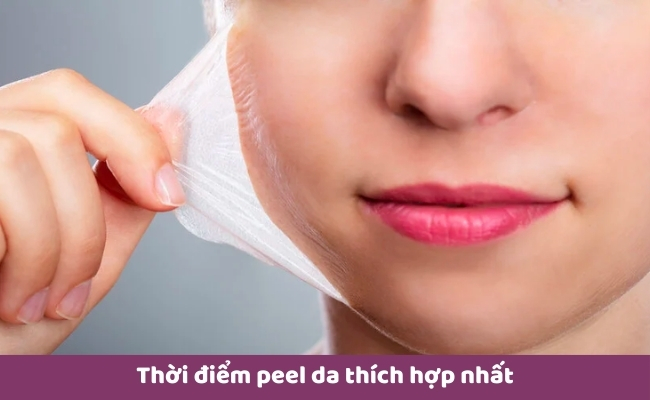 Thời điểm peel da thích hợp nhất