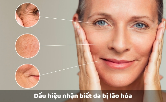 Dấu hiệu nhận biết da bị lão hóa