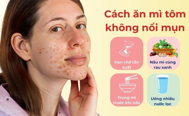 Cách ăn mì tôm không nổi mụn