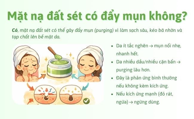 Mặt nạ đất sét có đẩy mụn không?