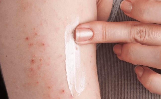 Tiêu chí chọn kem chống nắng SPF 50 đúng chuẩn nhất