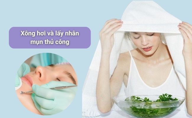 Cách lột mụn đầu đen tại nhà đơn giản, hiệu quả