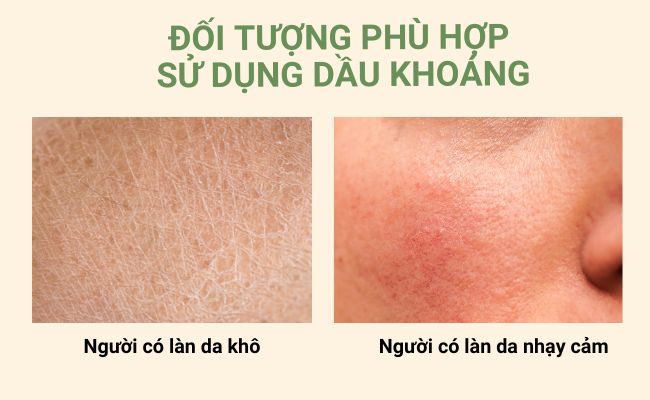 Dầu khoáng (Mineral Oil) phù hợp với làn da nào?
