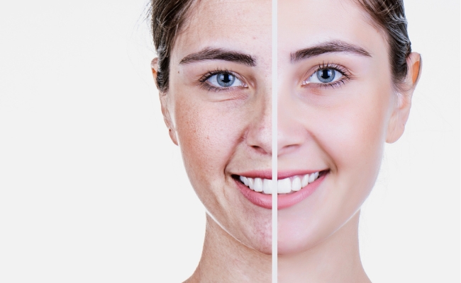 Tác dụng chống lão hóa của serum Niacinamide