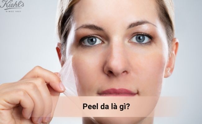 Peel da là gì?