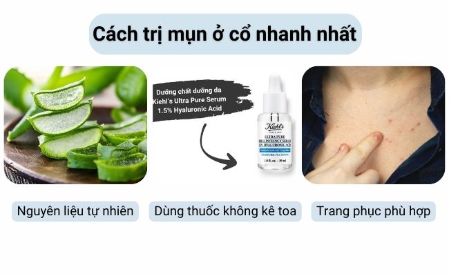 Việc chọn đúng sản phẩm và tuân thủ liều lượng sẽ giúp mụn cải thiện nhanh chóng mà không gây tổn hại đến da.