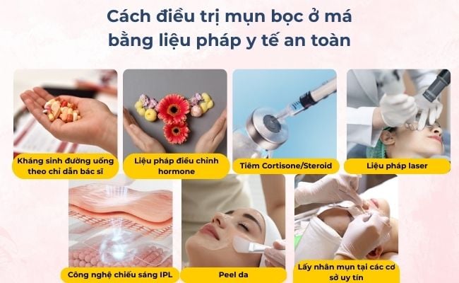 Lấy nhân mụn bọc ở má tại các cơ sở uy tín


