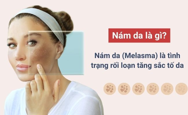 Nám da là gì?