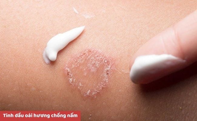 Tinh dầu hoa oải hương có tác dụng gì?