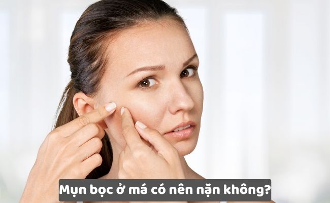 Mụn bọc ở má có nên nặn không?