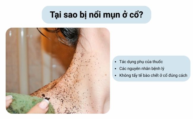 Không làm sạch hoặc tẩy tế bào chết vùng da cổ thường xuyên khiến lớp sừng tích tụ, gây bít tắc và hình thành mụn ở cổ.
