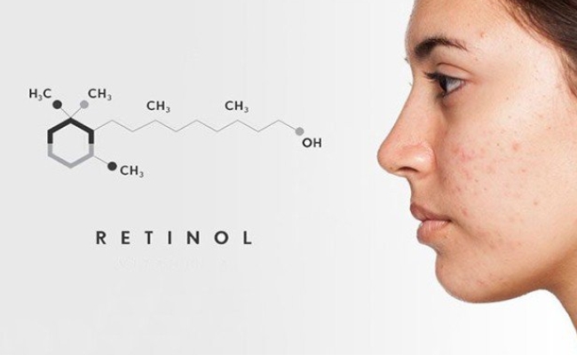 Retinol là gì