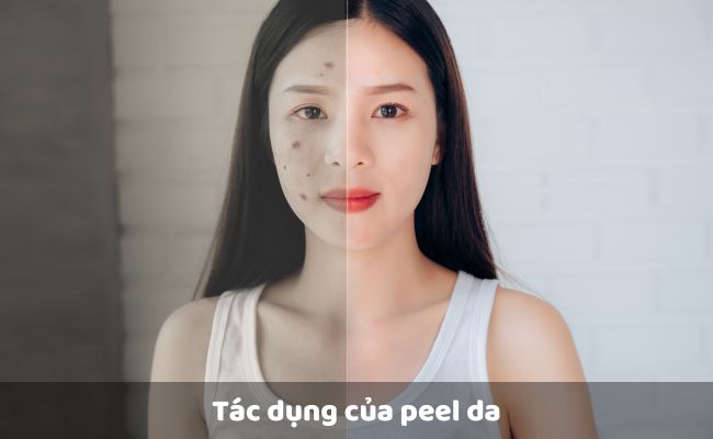 Tác dụng của peel da