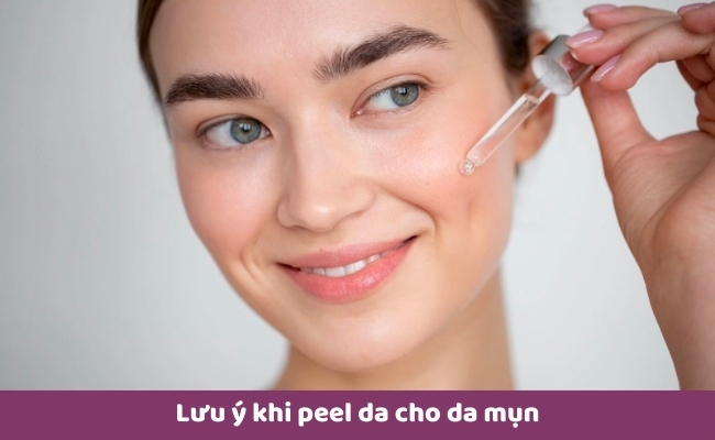Lưu ý khi peel da cho da mụn
