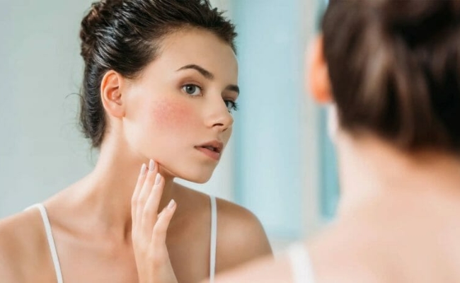 Thế nào là da nhạy cảm? Da nhạy cảm là gì?
