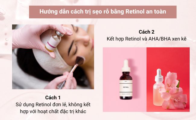 Sử dụng Retinol đúng tần suất và kết hợp dưỡng ẩm giúp giảm kích ứng da.