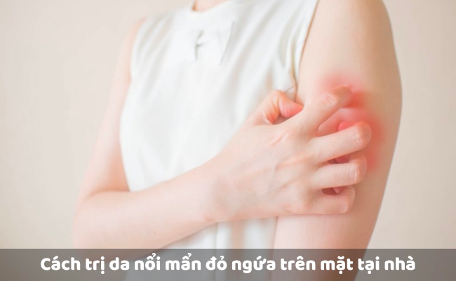 Một số lưu ý khi điều trị nổi mẩn đỏ ở da mặt