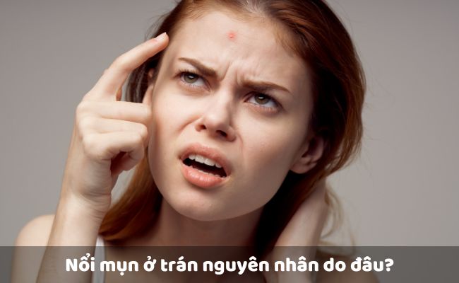 Nổi mụn ở trán nguyên nhân do đâu?