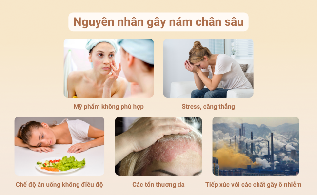 Các tác động từ môi trường và thói quen hằng ngày cũng có thể gây ra nám da