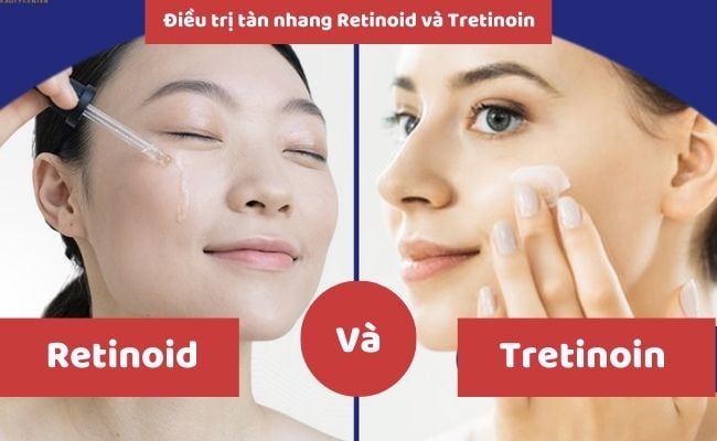 Cách trị tàn nhang tận gốc, an toàn, hiệu quả
