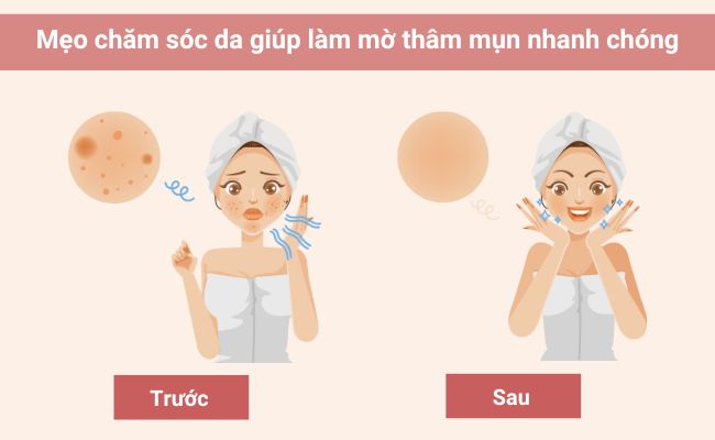 Mẹo chăm sóc da giúp làm mờ thâm mụn nhanh chóng