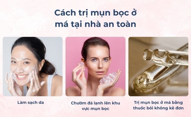 Trị mụn bọc ở má bằng thuốc bôi không kê đơn (OTC)

