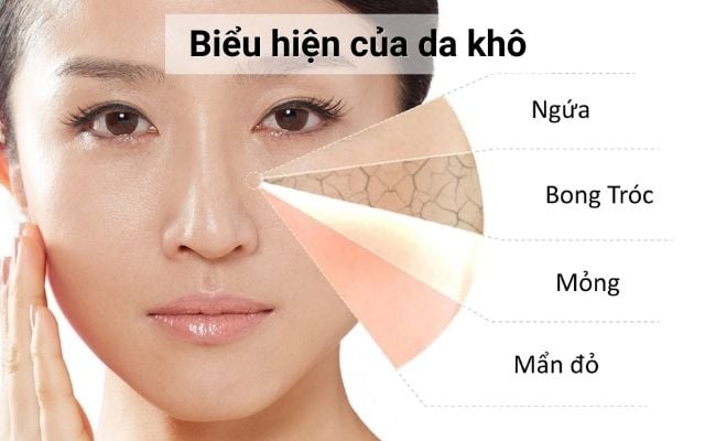 Da khô thiếu chất gì? Cách khắc phục da khô tại nhà hiệu quả