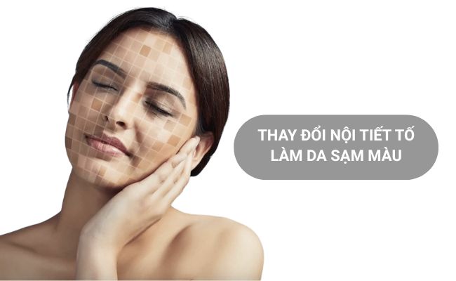Da không đều màu do rối loạn nội tiết tố