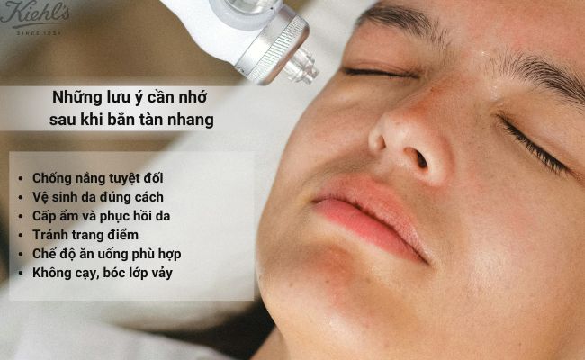 Những lưu ý cần nhớ sau khi bắn tàn nhang