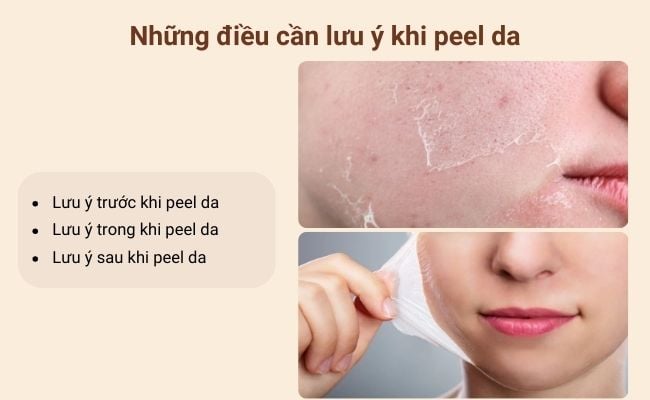 Những điều cần lưu ý khi peel da là gì?