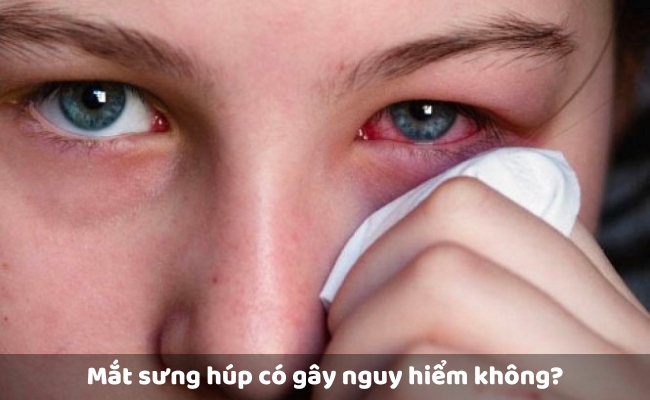Mắt sưng húp có gây nguy hiểm không?