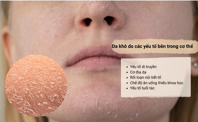Nguyên nhân gây khô da là gì