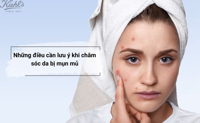 Những điều cần lưu ý khi chăm sóc da bị mụn mủ