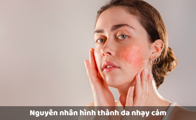Nguyên nhân hình thành da nhạy cảm