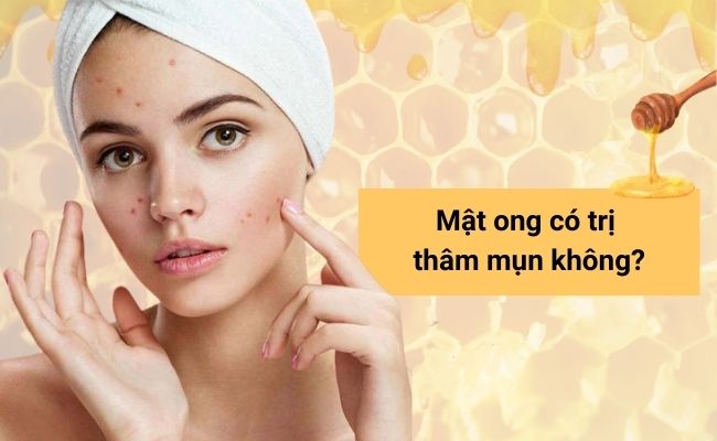 Mật ong chứa nhiều dưỡng chất giúp làm dịu da và hỗ trợ giảm thâm mụn.