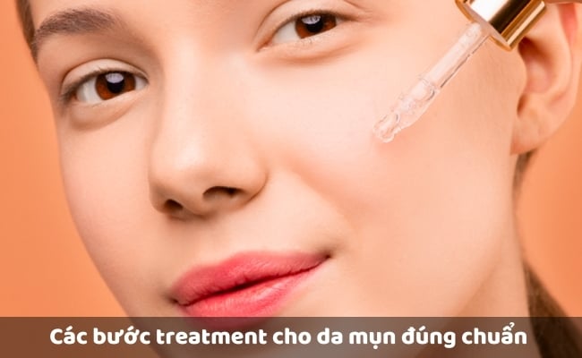 Các bước treatment cho da mụn đúng chuẩn