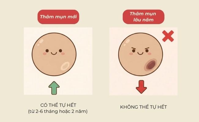 Thâm mụn có tự hết không?