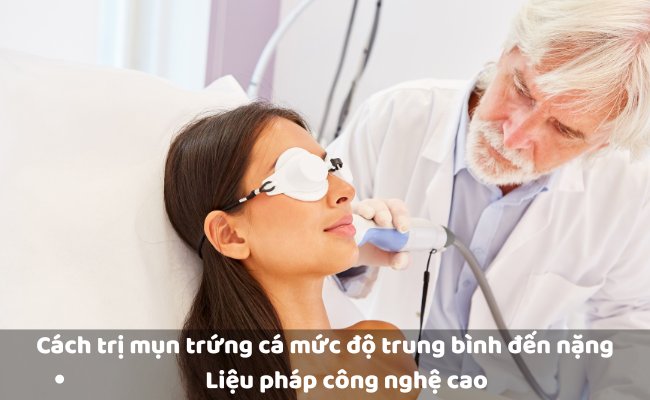 Trị mụn bằng công nghệ cao