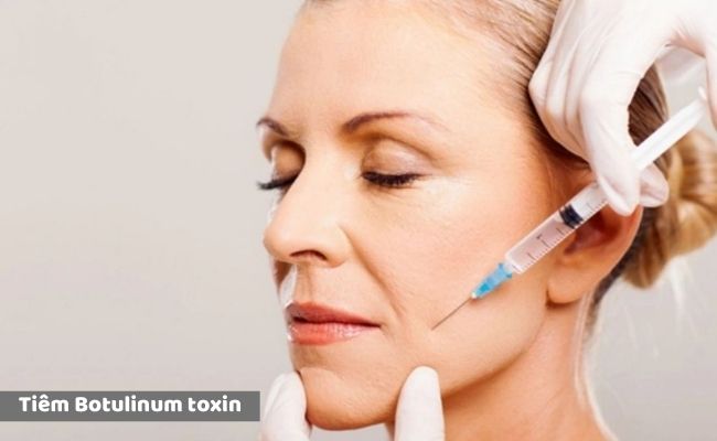 Cách điều trị nếp nhăn trên mặt hiệu quả