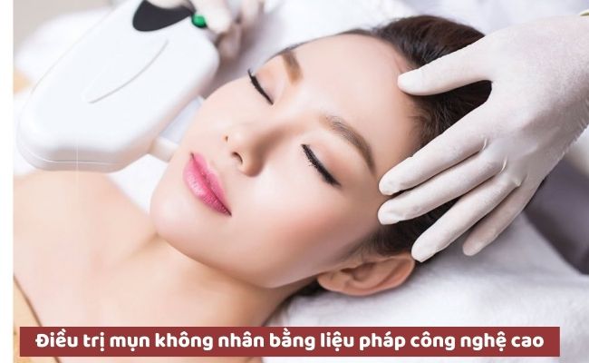 Cách trị mụn không nhân an toàn, hiệu quả