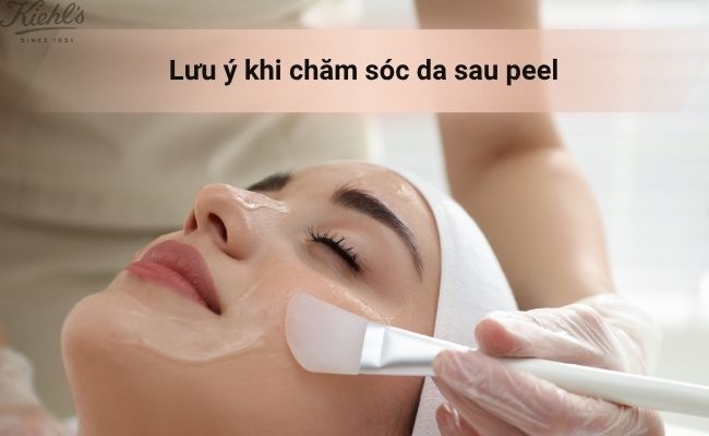 Lưu ý khi chăm sóc da sau peel