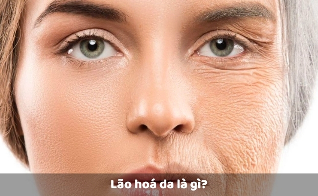 Lão hóa da là gì?