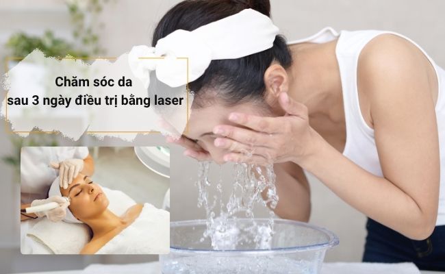 Từ ngày 1 đến ngày 3, làn da sau laser cần được làm sạch nhẹ nhàng, tránh tác động mạnh