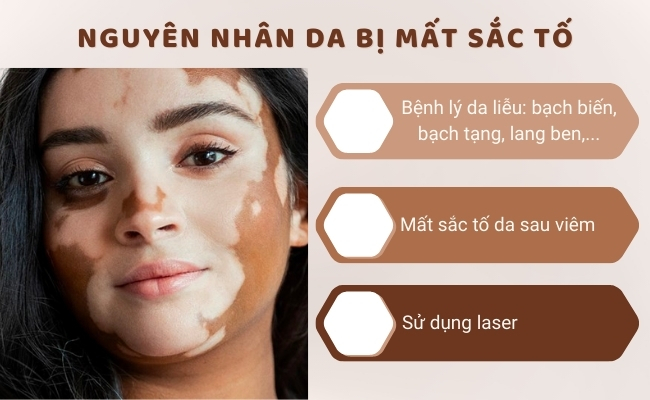 Da mất sắc tố là dấu hiệu cảnh báo tình trạng tổn thương có thể do nhiều nguyên nhân gây ra. (Nguồn: Kiehl’s)
