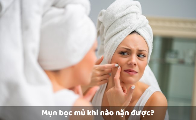 Mụn bọc mủ khi nào nặn được?
