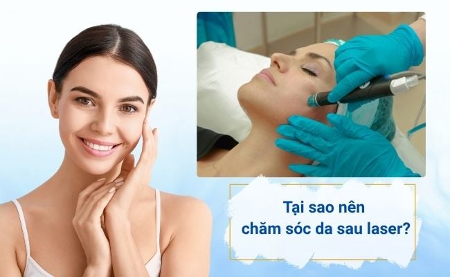 Việc chăm sóc da sau laser đúng cách giúp da phục hồi nhanh và duy trì hiệu quả điều trị lâu dài