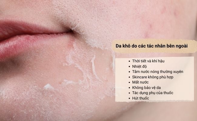 yếu tố bên ngoài gây da khô