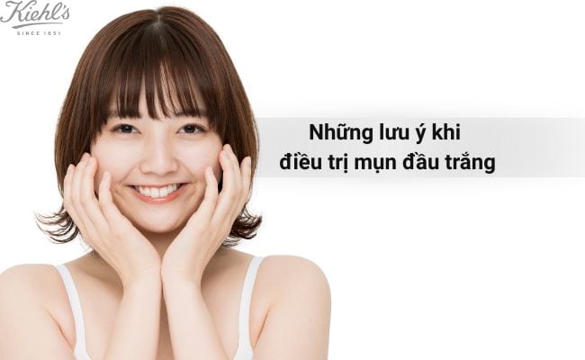 Những lưu ý khi điều trị mụn đầu trắng