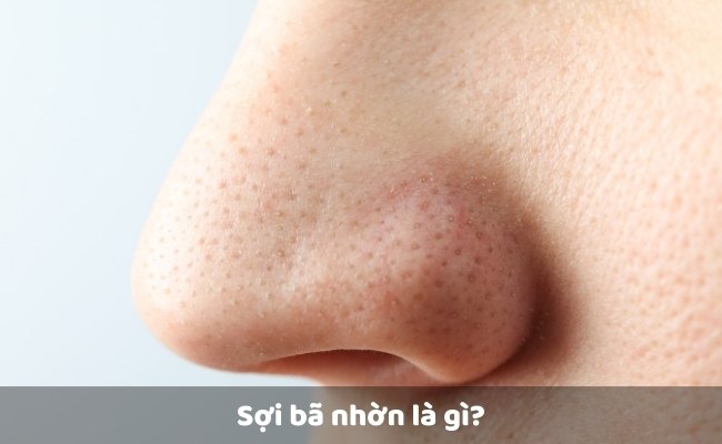 Sợi bã nhờn là gì?