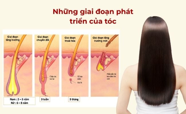 Những giai đoạn phát triển của tóc
